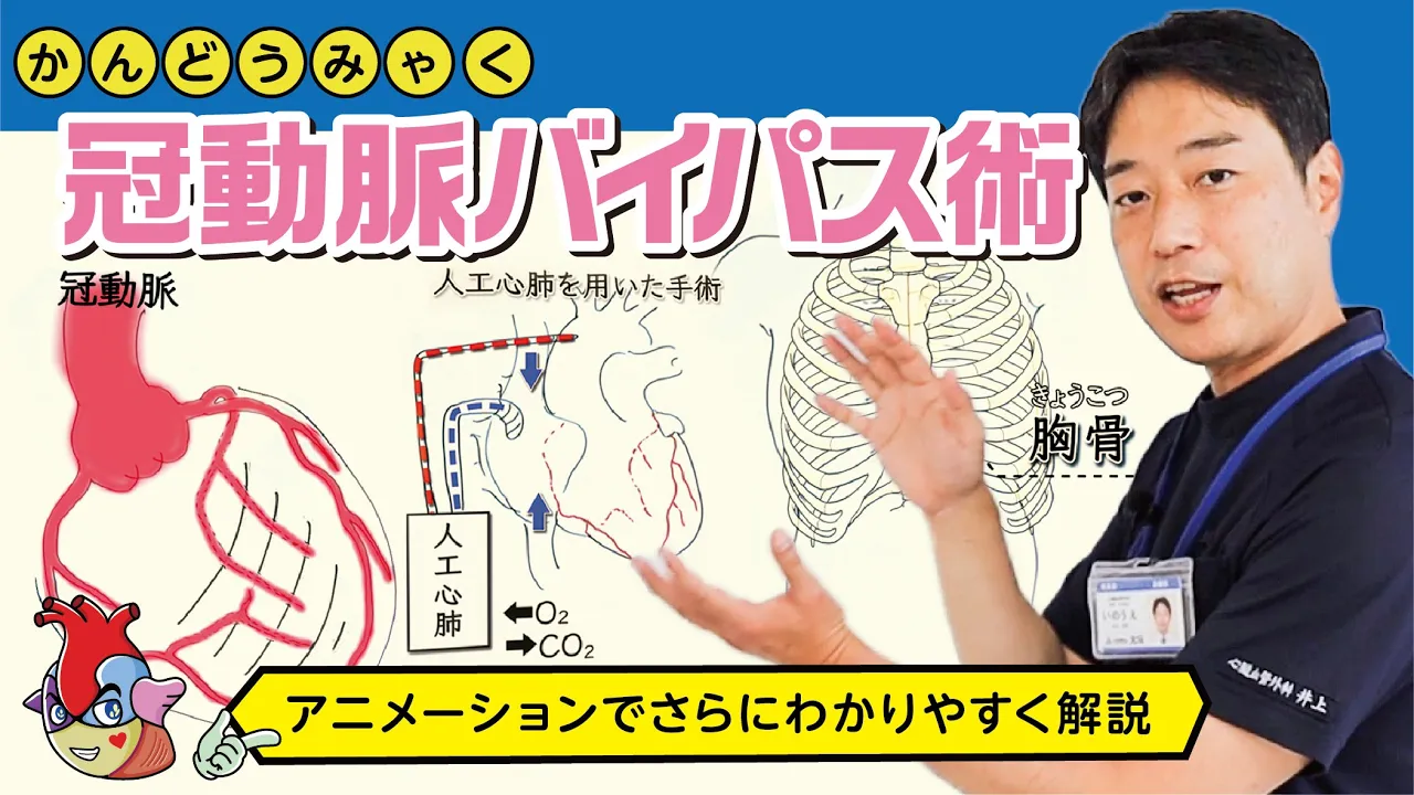 バイパス手術と開胸手術の副作用とリスク