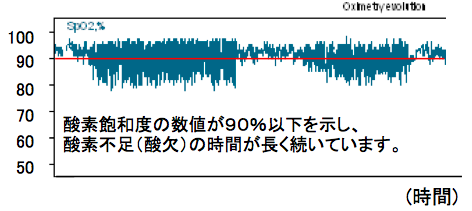 睡眠時無呼吸症候群 北海道 帯広 十勝 社会医療法人北斗 北斗病院 北斗クリニック