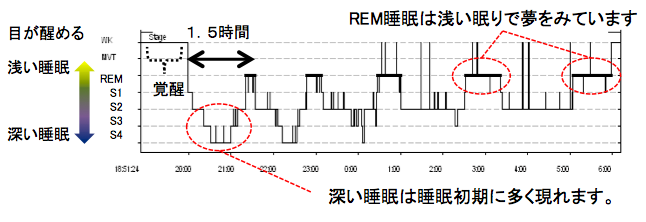 睡眠時無呼吸症候群 北海道 帯広 十勝 社会医療法人北斗 北斗病院 北斗クリニック